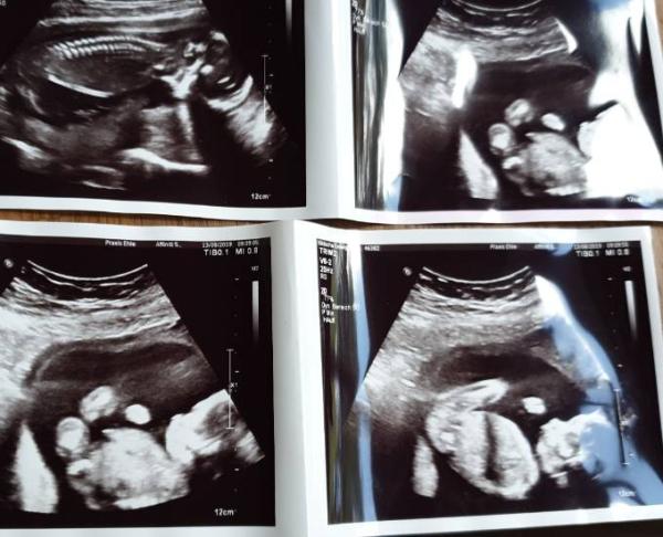 Bild zu Outing 🥰 - Forum für Januar - Mamis