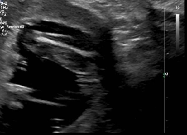 Bild zu FA-Termin - Forum für Januar - Mamis