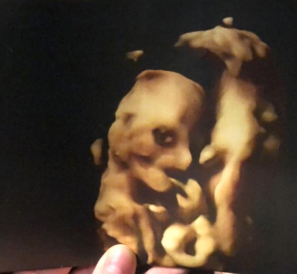 Bild zu Babykino - Forum für Januar - Mamis