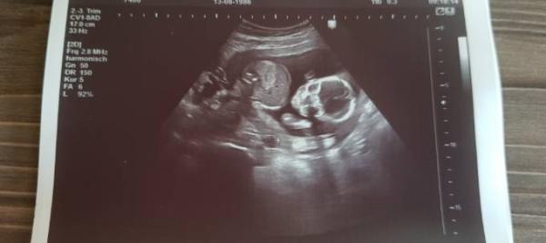 Bild zu Endlich wieder FA Termin mit Outing - Forum für Januar - Mamis