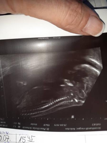 Bild zu Wieder mal eine Vorsorge überstanden - Forum für Januar - Mamis