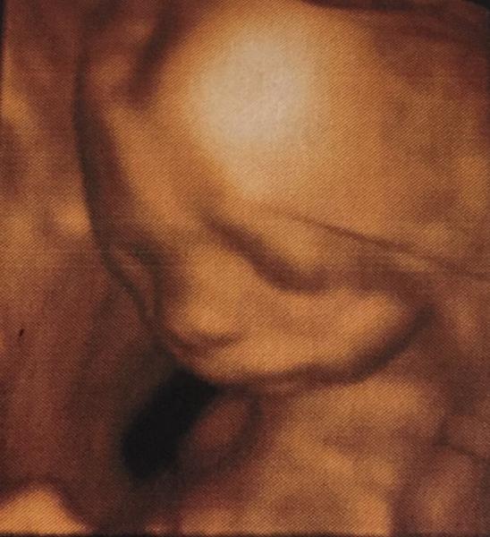 Bild zu Feindiagnostic - Forum für Januar - Mamis