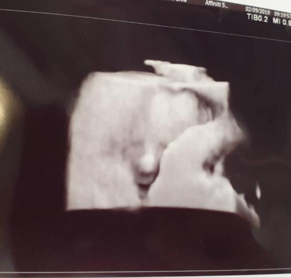 Bild zu Heute 2.großer Ultraschall 🥰 - Forum für Januar - Mamis