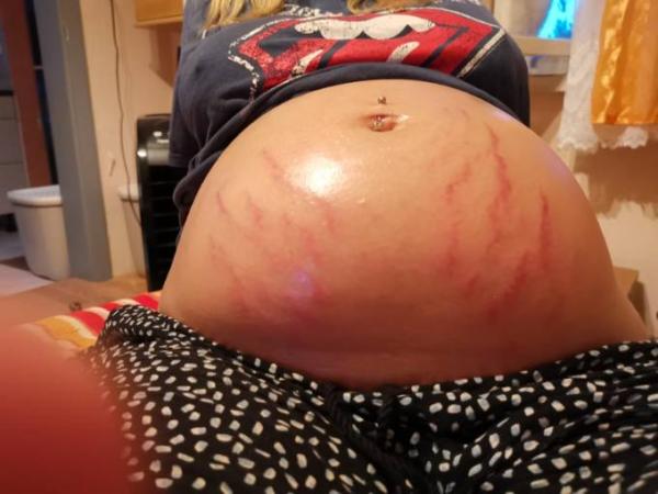 Bild zu Streifen - Forum für Januar - Mamis