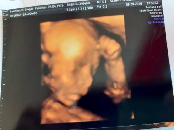 Bild zu Pränataldiagnostik - Forum für Januar - Mamis