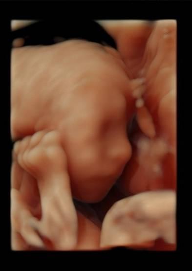 Bild zu Feindiagnostik mit eindeutigem Outing 😍 - Forum für Januar - Mamis