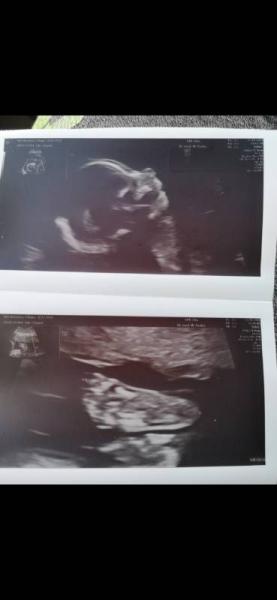 Bild zu Endlich gute Nachrichten - Forum für Januar - Mamis