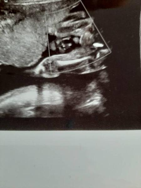 Bild zu Outing - Forum für Januar - Mamis