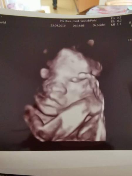 Bild zu Heute endlich wieder Termin gehabt - Forum für Januar - Mamis