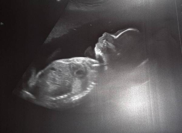 Bild zu Der nächste Termin - Forum für Januar - Mamis