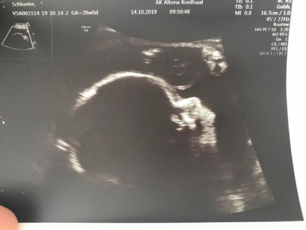 Bild zu Geplanter Kaiserschnitt am 23.12.19 - Forum für Januar - Mamis