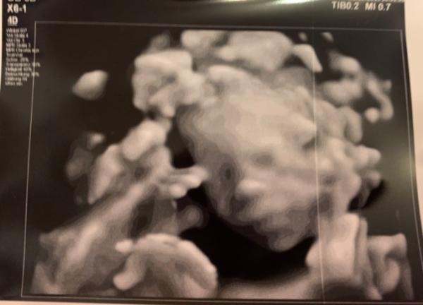 Bild zu Viel hin und her in der letzten Zeit... - Forum für Januar - Mamis