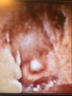 Bild zu 3 großer Ultraschall - Forum für Januar - Mamis