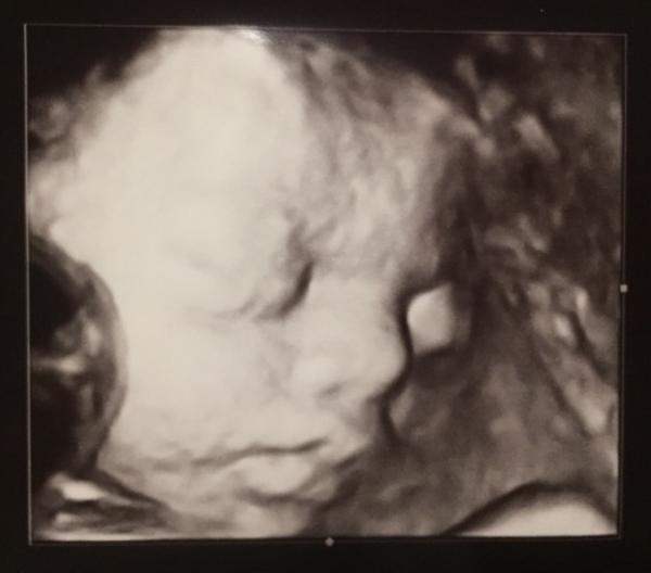 Bild zu 3. Screening - Forum für Januar - Mamis