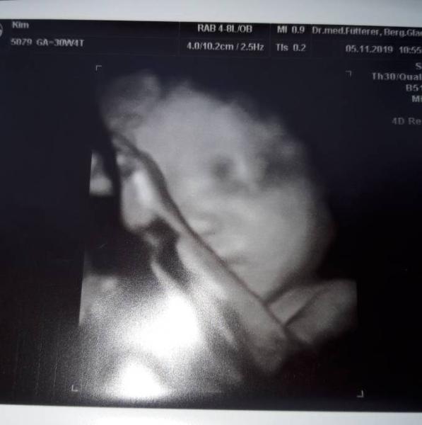 Bild zu 3tes Screening heute - Forum für Januar - Mamis