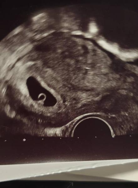 Bild zu Ramzi - Forum für Januar - Mamis