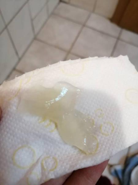 Bild zu Schleimpfropf Abgang?? - Forum für Januar - Mamis