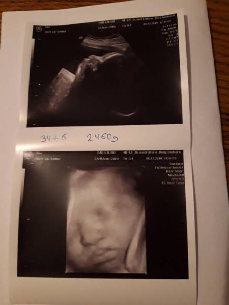 Bild zu Gestern wieder Untersuchung gehabt - Forum für Januar - Mamis