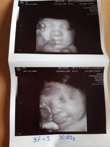 Bild zu Untersuchung :) 38 Woche - Forum für Januar - Mamis