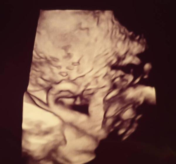 Bild zu Auch heute VU 🥰 - Forum für Januar - Mamis