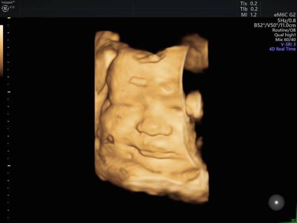 Bild zu Schockverliebt - Forum für Januar - Mamis