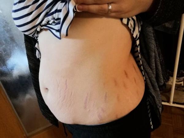 Bild zu Speckbauch-Sonntag - Forum für Januar - Mamis