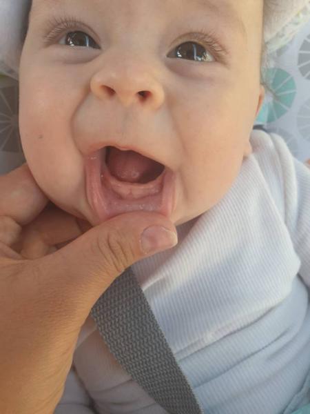 Bild zu Was würdet ihr sagen? Zähne? - Forum für Januar - Mamis