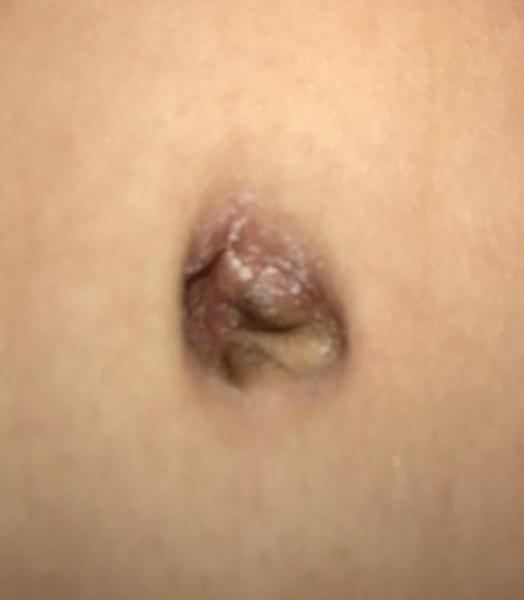 Bild zu Babys Nabel - Forum für Januar - Mamis