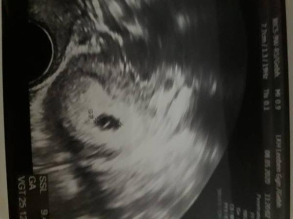 Bild zu Ultraschallbild - Forum für Januar - Mamis