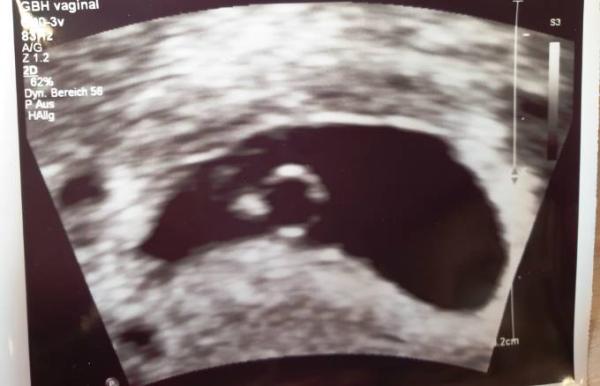 Bild zu Auch ich reihe mich mit ein :) ... - Forum für Januar - Mamis