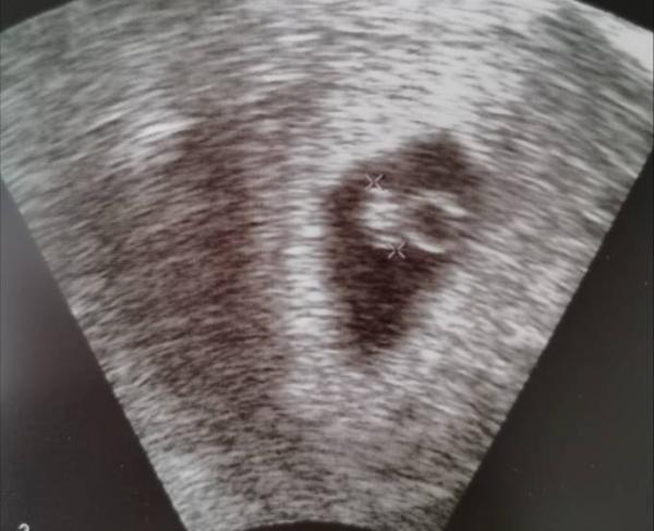 Bild zu Zurück vom 1. FA Termin - Forum für Januar - Mamis