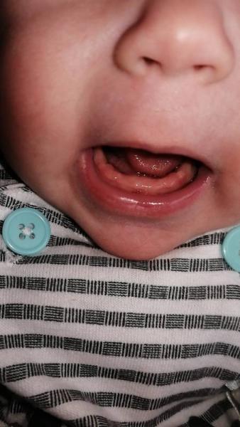 Bild zu Zähne - Forum für Januar - Mamis