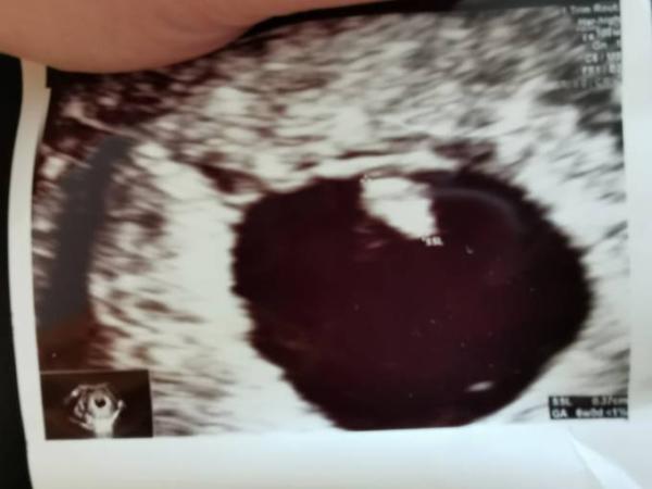 Bild zu 2. FA Termin - Forum für Januar - Mamis