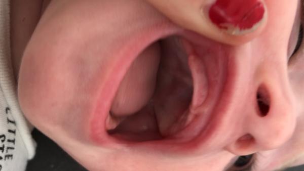 Bild zu Schon ein Zahn oder was ist das ? - Forum für Januar - Mamis