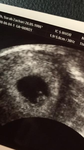 Bild zu Erster Termin & erleichtert - Forum für Januar - Mamis
