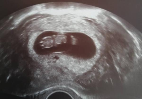 Bild zu Lang ersehnter FA Termin - Forum für Januar - Mamis