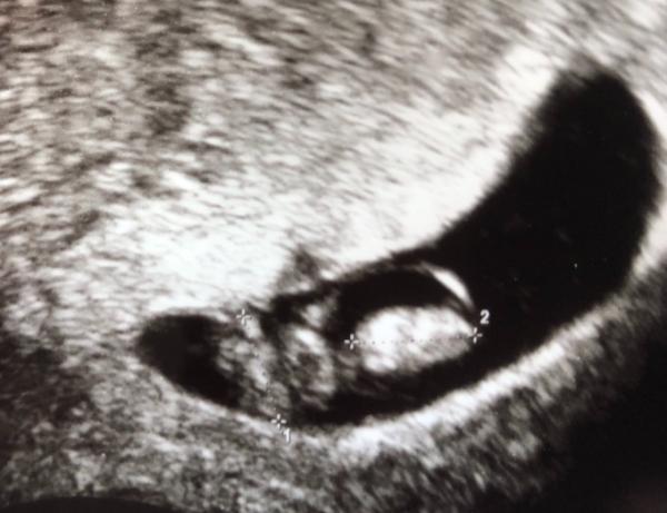 Bild zu 2ter FA-Termin - Forum für Januar - Mamis