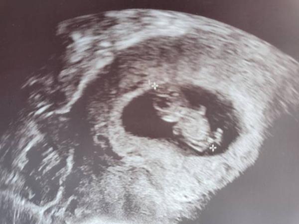 Bild zu 2. Termin heute - Forum für Januar - Mamis