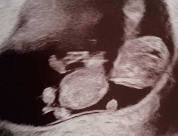 Bild zu Auch hier gute Nachrichten - Forum für Januar - Mamis