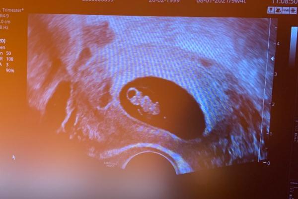 Bild zu Ebenfalls Gute Neuigkeiten đź’“ - Forum fĂĽr Januar - Mamis