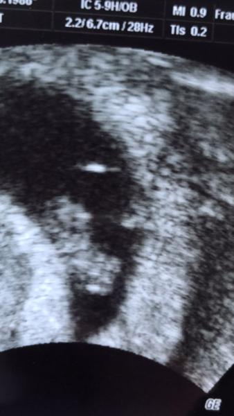 Bild zu Happy & gutes Gefühl - Forum für Januar - Mamis