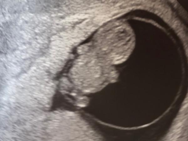 Bild zu 1. FA-Termin & so glücklich - Forum für Januar - Mamis