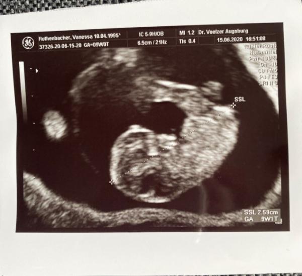 Bild zu 2. FA Termin glücklich - Forum für Januar - Mamis