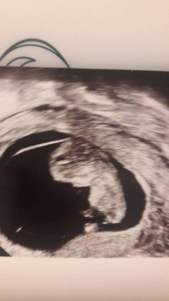 Bild zu Ich reihe mich auch noch ein - Forum für Januar - Mamis