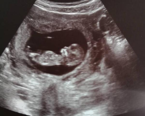 Bild zu Guten Morgen :) - Forum für Januar - Mamis