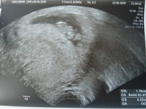 Bild zu 💕Da ist endlich das Gummibärchen 💕 - Forum für Januar - Mamis