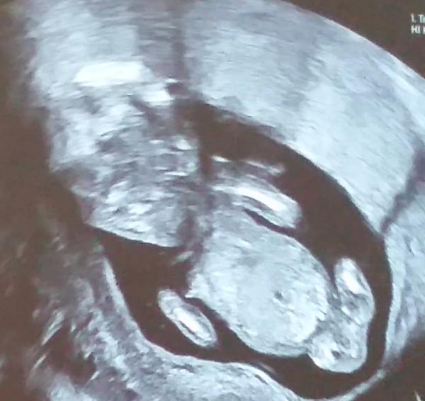 Bild zu ETS und soweit alles prima - Forum für Januar - Mamis