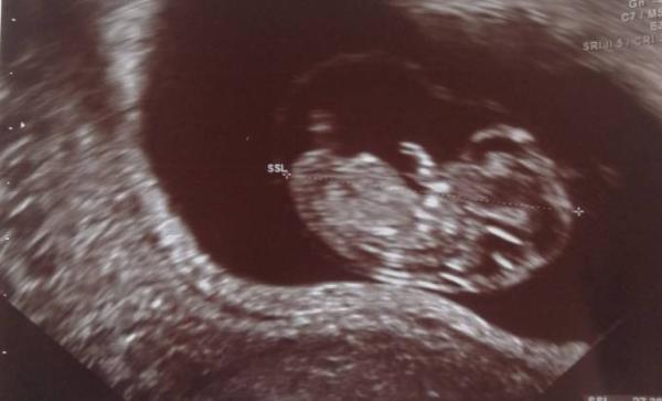 Bild zu Noch Platz frei? - Forum für Januar - Mamis