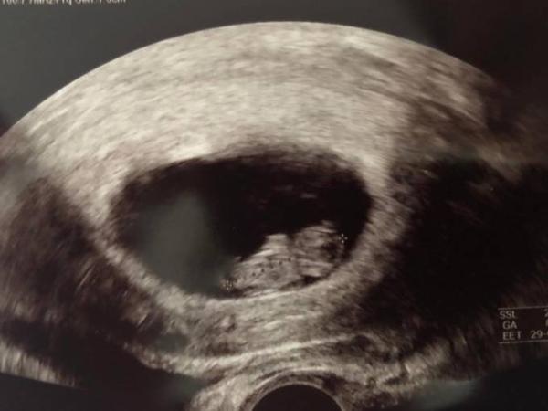 Bild zu 2. Ultraschall und so froh - Forum für Januar - Mamis