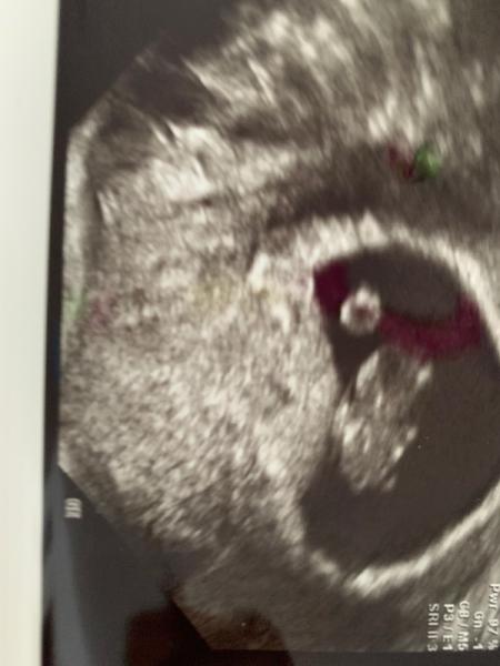 Bild zu FA Termin geschafft - Forum für Januar - Mamis